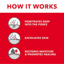 Tropiclean Oxy-Med Treatment Rinse For Pets (20 oz)