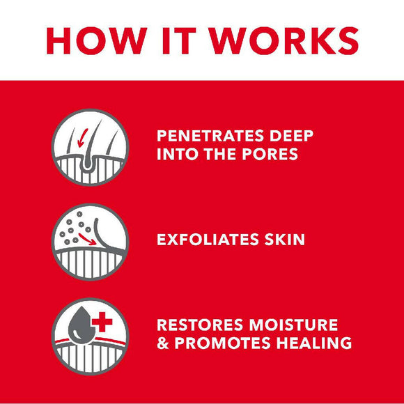 Tropiclean Oxy-Med Treatment Rinse For Pets (20 oz)