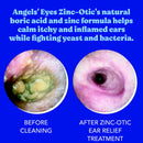 Before and after treatment of ear cleaning with Angels' Eyes Zinc-Otic on a blue background.